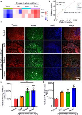 Protein disulfide isomerase A6 promotes the repair of injured nerve through interactions with spastin